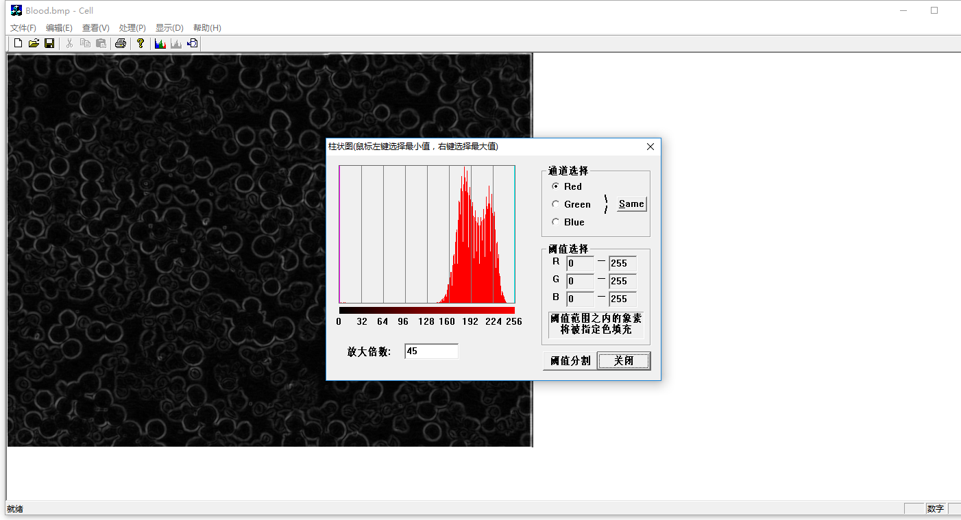 VC++医用血液、细胞识别程序源代码